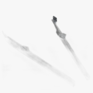 V-dissel PL2035 ALKO